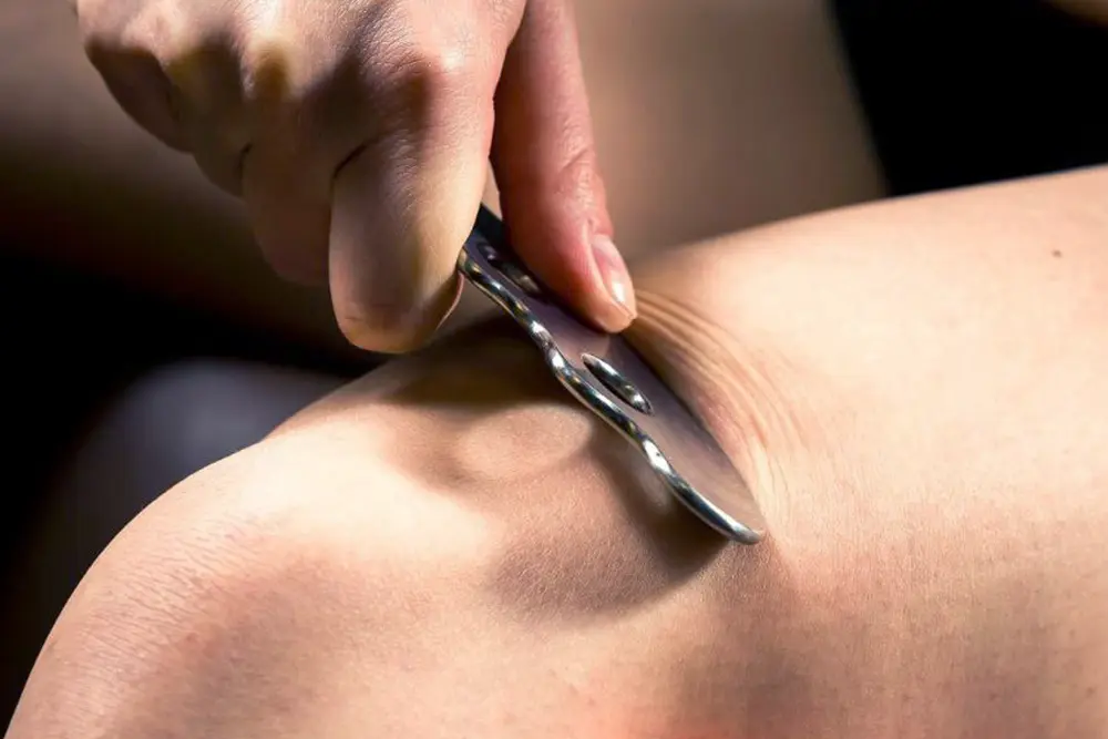 Instrumentaalne Pehmete Kudede Mobiliseerimine (NordBlade)