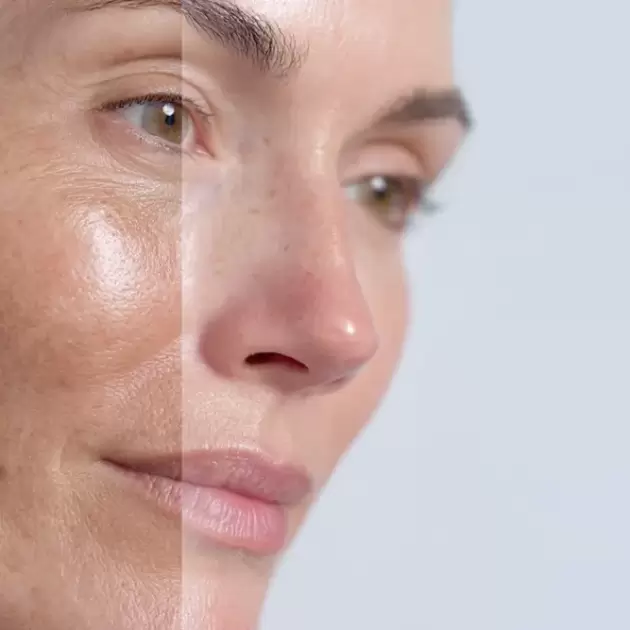 Фасциальное моделирование лица: "сухая" техника